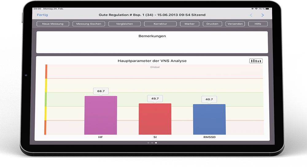 VNS-HRV-Analyse_1000 image VNS HRV Analyse 1000